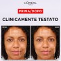 L'ORÉAL PARIS AA547100 CREMA-GEL RIMPOLPANTE REVITALIFT FILLER, ACIDO IALURONICO MICRO-EPIDERMICO, PER UNA PELLE IDRATATA PIÙ A LUNGO, 50 ML