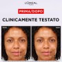SET 2 L'ORÉAL PARIS AA547100 CREMA-GEL RIMPOLPANTE REVITALIFT FILLER, ACIDO IALURONICO MICRO-EPIDERMICO, PER UNA PELLE IDRATATA PIÙ A LUNGO, 50 ML